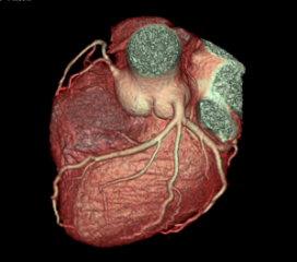 Cardiac 1