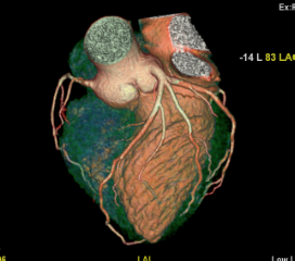 Cardiac 10