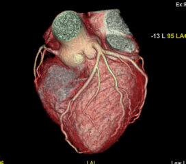 Cardiac 11