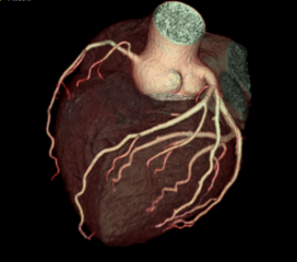 Cardiac 2