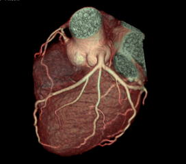 Cardiac 3
