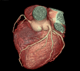 Cardiac 4
