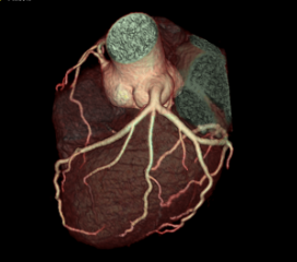 Cardiac 6