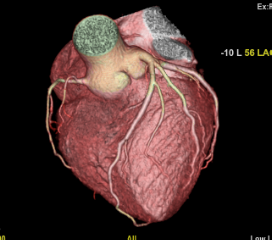 Cardiac 7