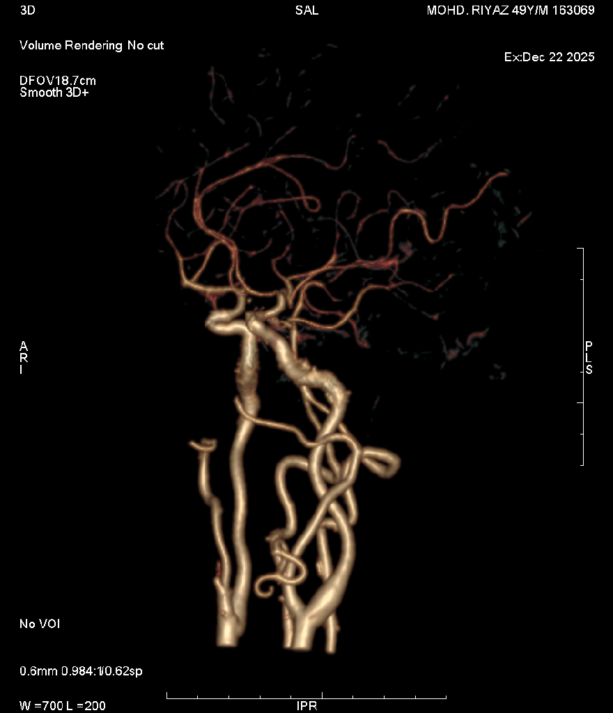 Angiography 4