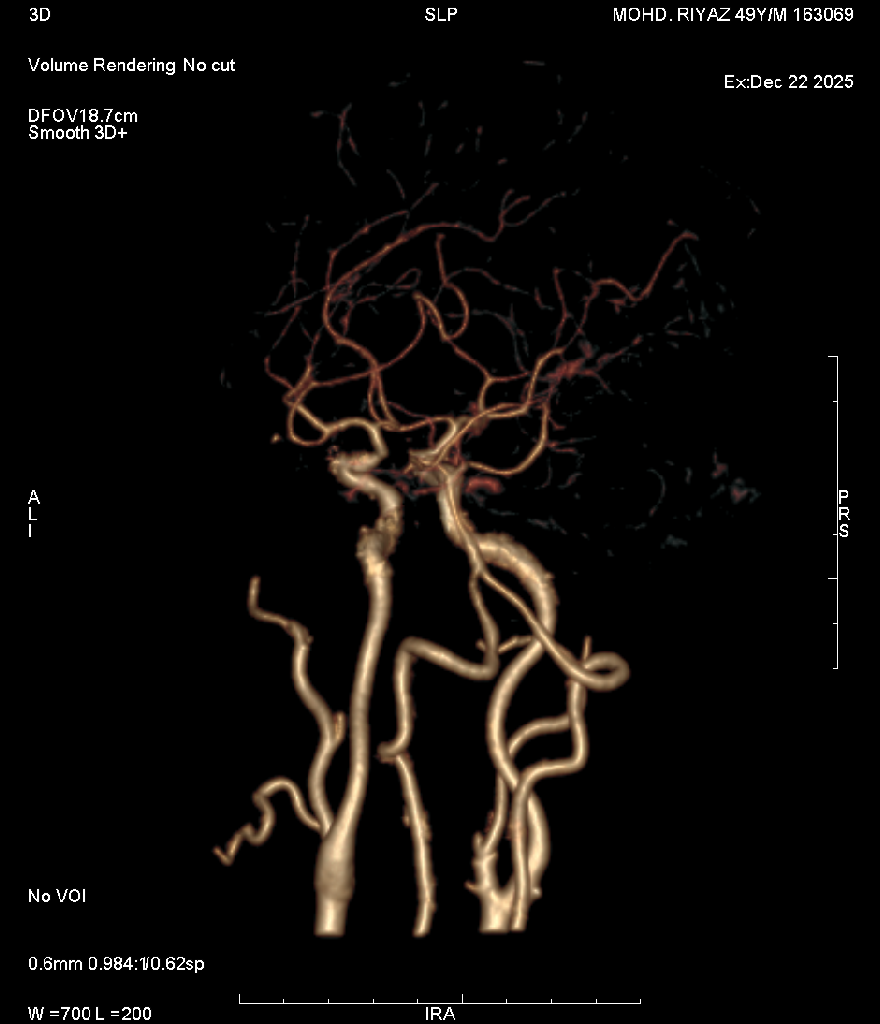 Angiography 5