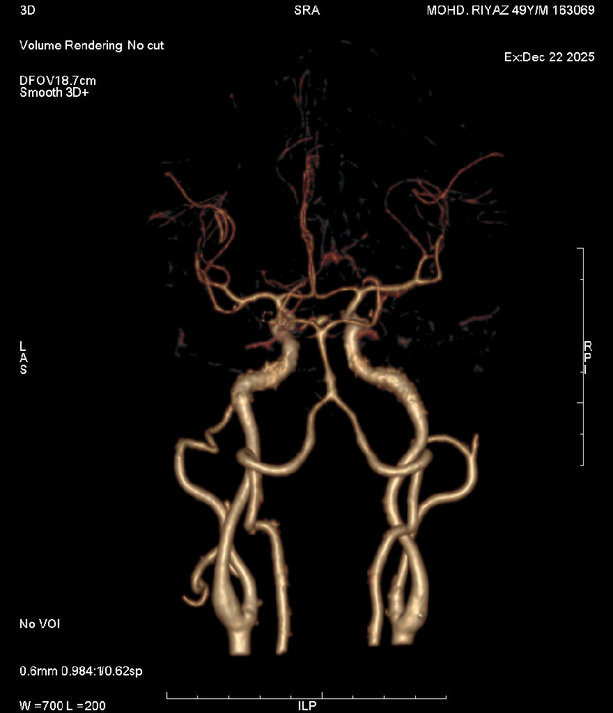 Angiography 6
