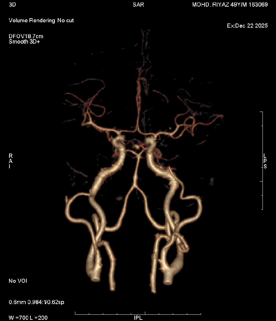 Angiography 8